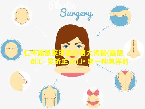 仁怀露龈笑矫正价格大揭秘(露龈 🌷 笑矫正 🐺 是一种怎样的体验)